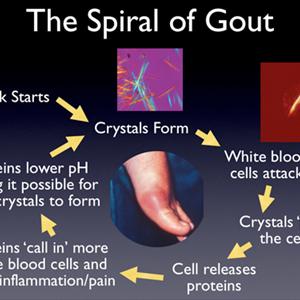 Gout Remedies - What Can People With Gout Do To Stay Healthy?