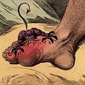 Beverages Lowest In Purines - The Dropped Key Of Ankle Gout